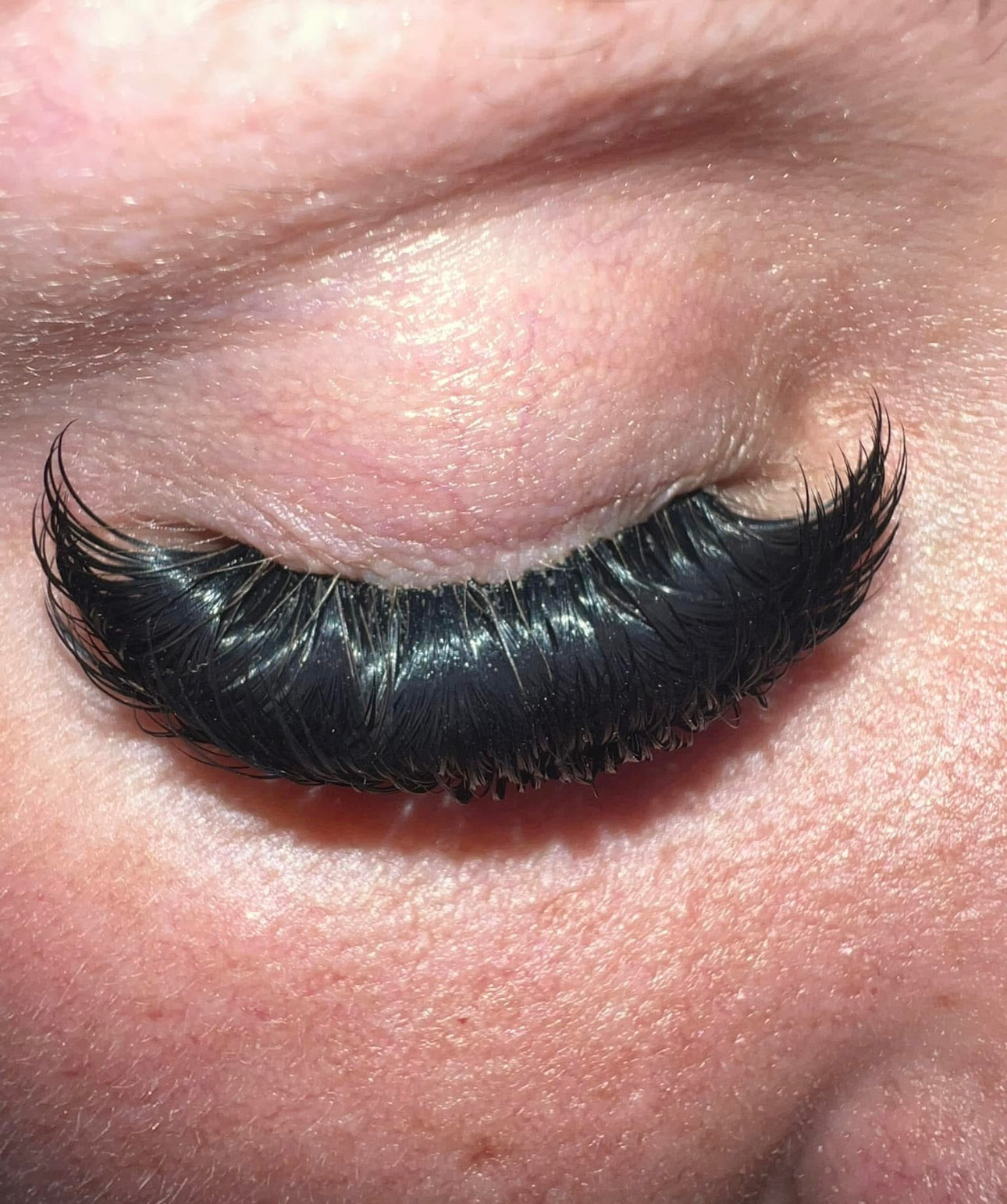 Why Eyelash Extensions Should Never Be Glued to the Eyelid