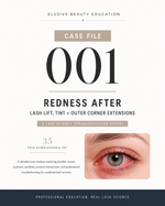 Case File 001: Redness After Lash Lift, Tint + Outer Corner Extensions